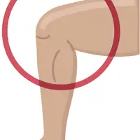 Picture for Knee (Diz)