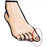 Picture for Toe (Ayak parmağı)